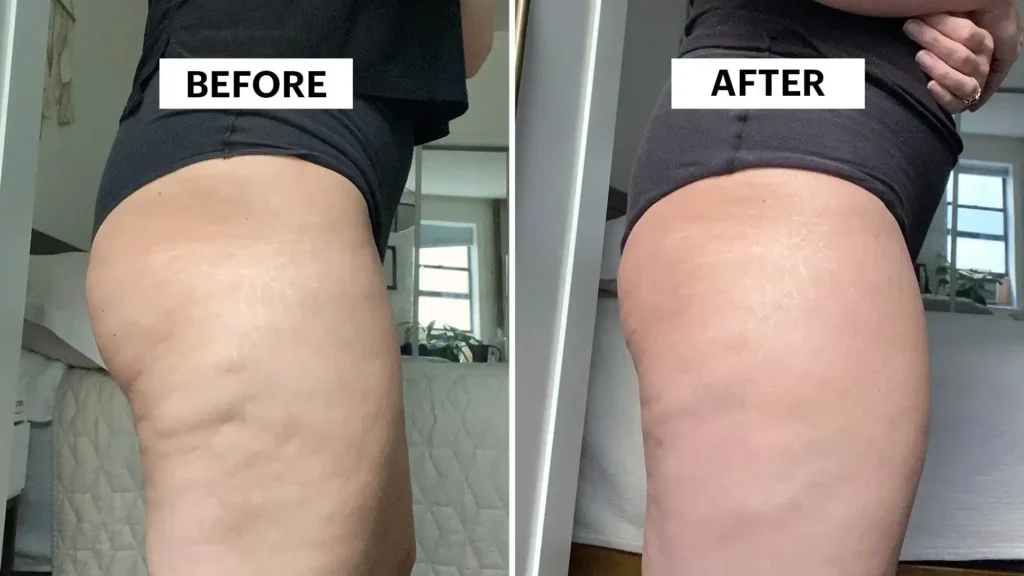 Do Toning Exercise Cirencester Really Tackle Cellulite?