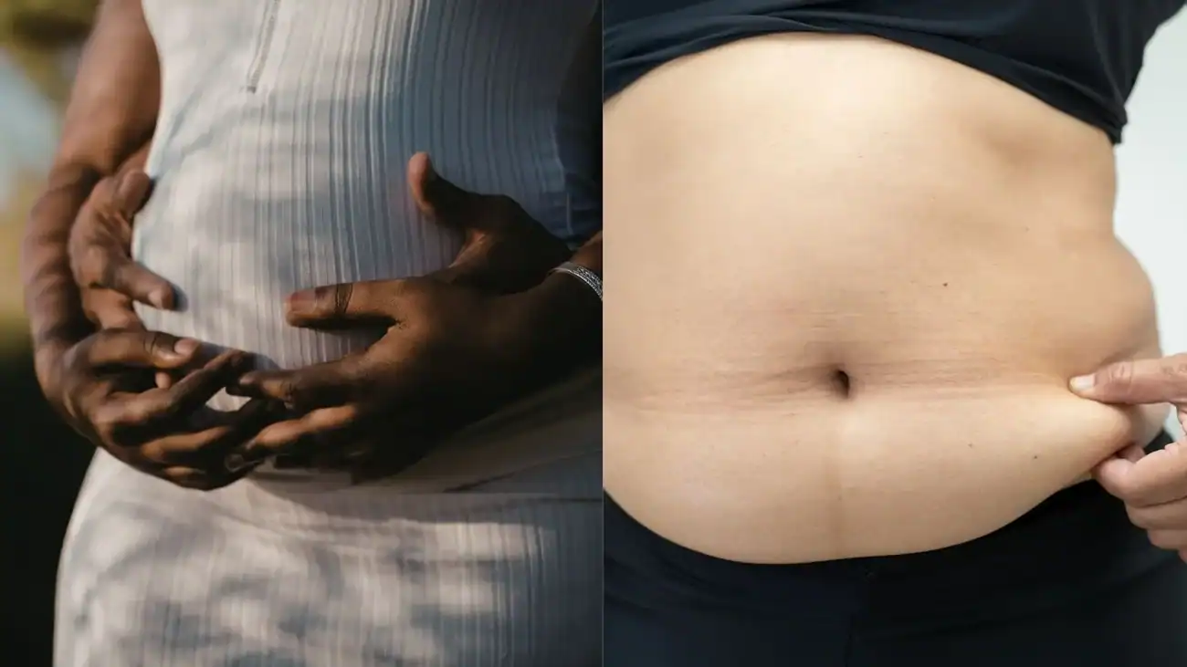 Do Belly Bands Help Prevent Diastasis Recti? 4 where Belly Bands Help and Where They Don’t mistakes to avoid